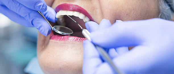 Best Emergency Root Canal Treatment in Riceville, TN